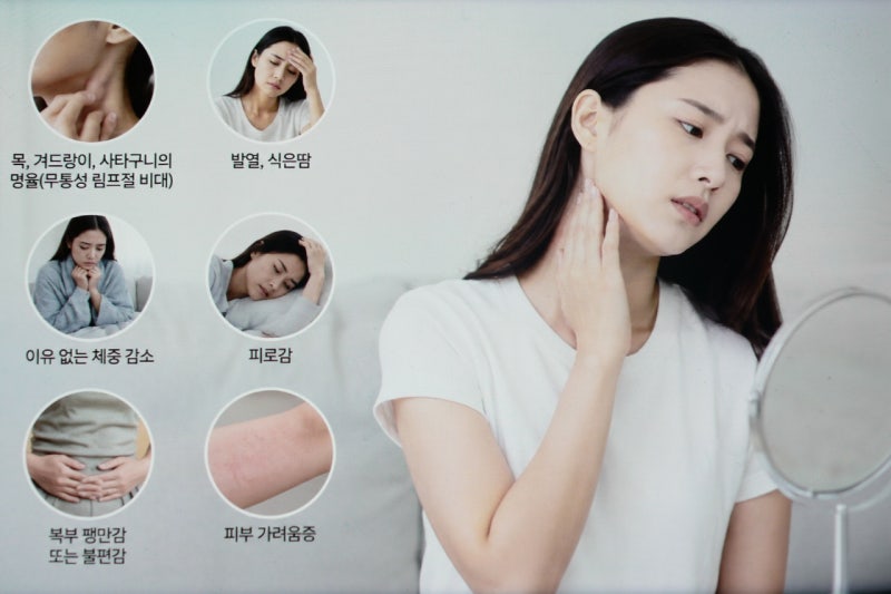 림프종 증상, 악성림프종 의심할 수 있는 신호와 검사 방법