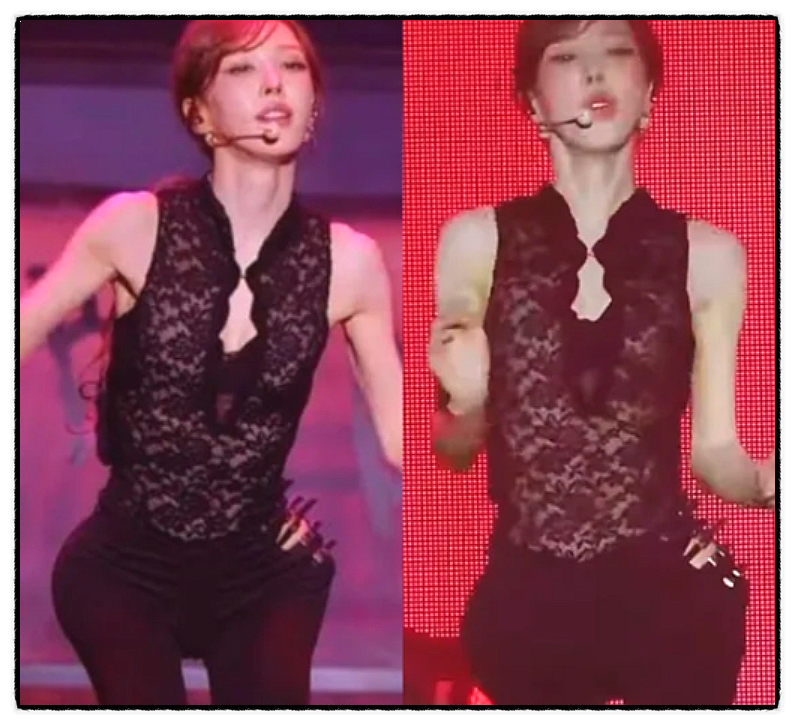 레드벨벳 웬디 골반 패드 의혹 뭐길래? 깡마른 몸매 둘러싼 악플 논란