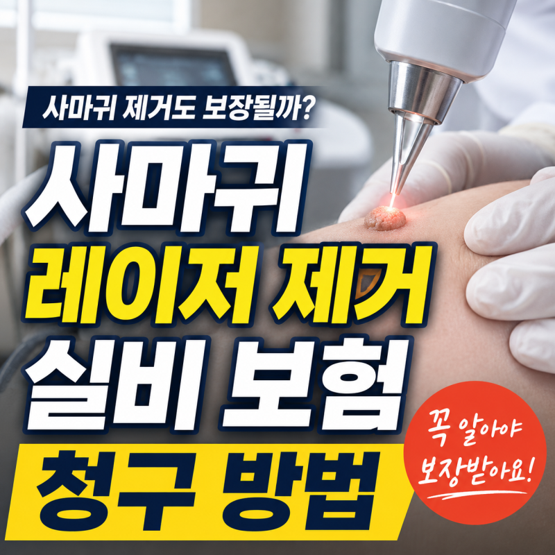 사마귀 레이저 제거 실비 청구 방법 및 보장 범위