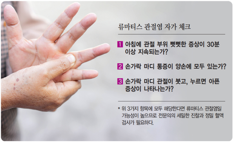 류마티스 관절염 자가 체크 방법, 퇴행성 관절염과의 차이와 치료법