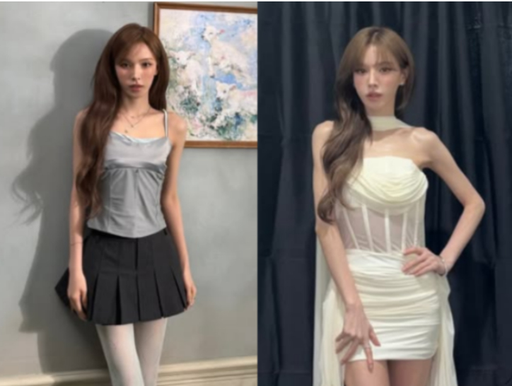 레드벨벳 웬디 단발부터 영스트리트, 피지컬/다이어트 화제성까지 싹 정리