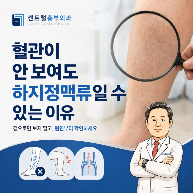 혈관이 안 보여도 하지정맥류일 수 있는 이유