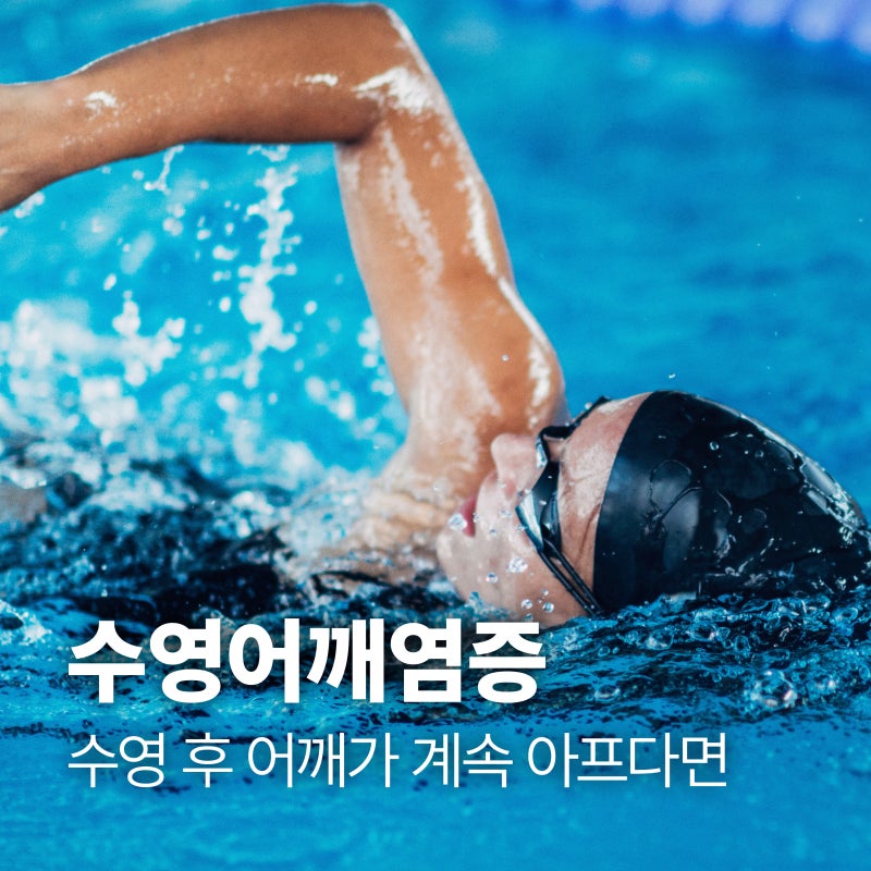 수영어깨염증, 수영 후 어깨가 계속 아프다면