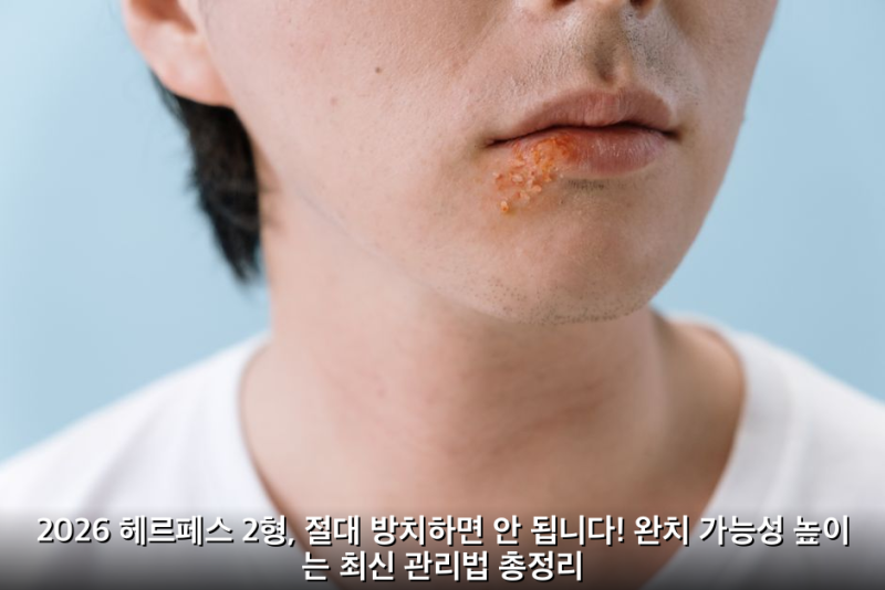 2026 헤르페스 2형, 절대 방치하면 안 됩니다! 완치 가능성 높이는 최신 관리법 총정리