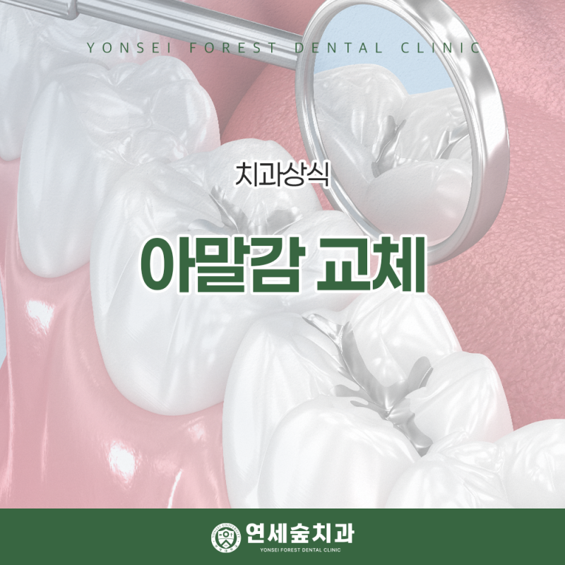 아말감 교체 멀쩡해 보여도 확인이 필요한 이유