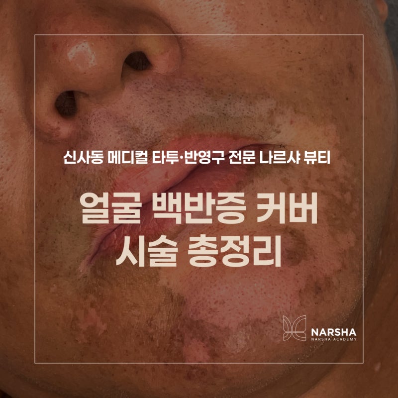 얼굴 백반증 커버 시술 총정리!입술·입꼬리·입주변·턱 부위별 안내