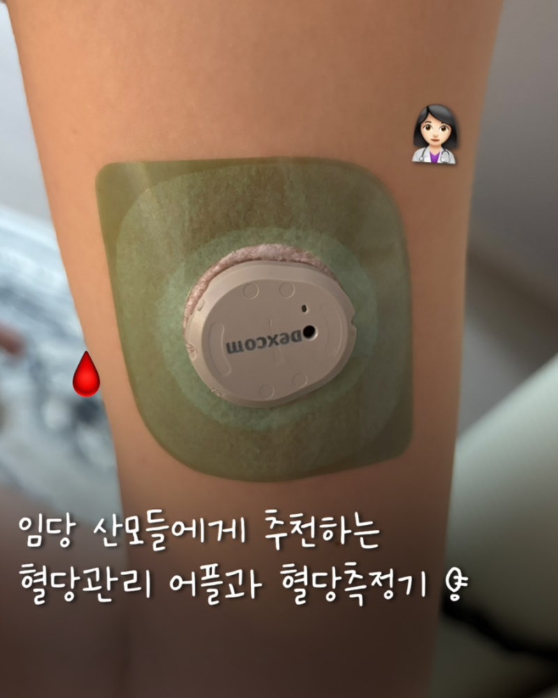 [임신 기록] 간호사 엄마가 임당 산모에게 추천하는 데스콤G7연속혈당측정기 사용 후기 ; 카....