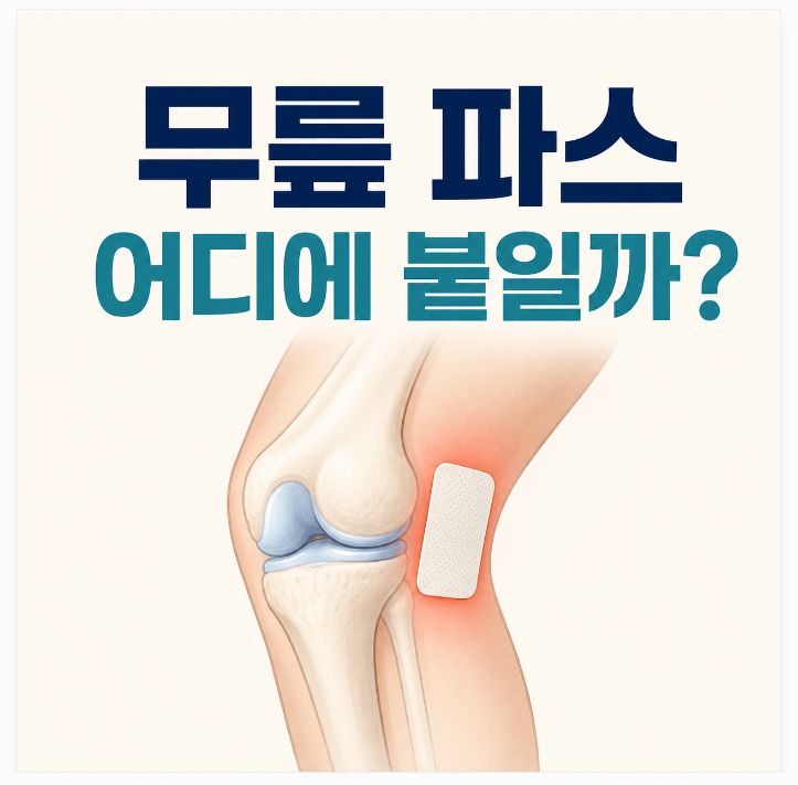 무릎 파스 어디에 붙여야 할까? 잘 떨어지지 않게 붙이는 위치와 무릎 전용 파스