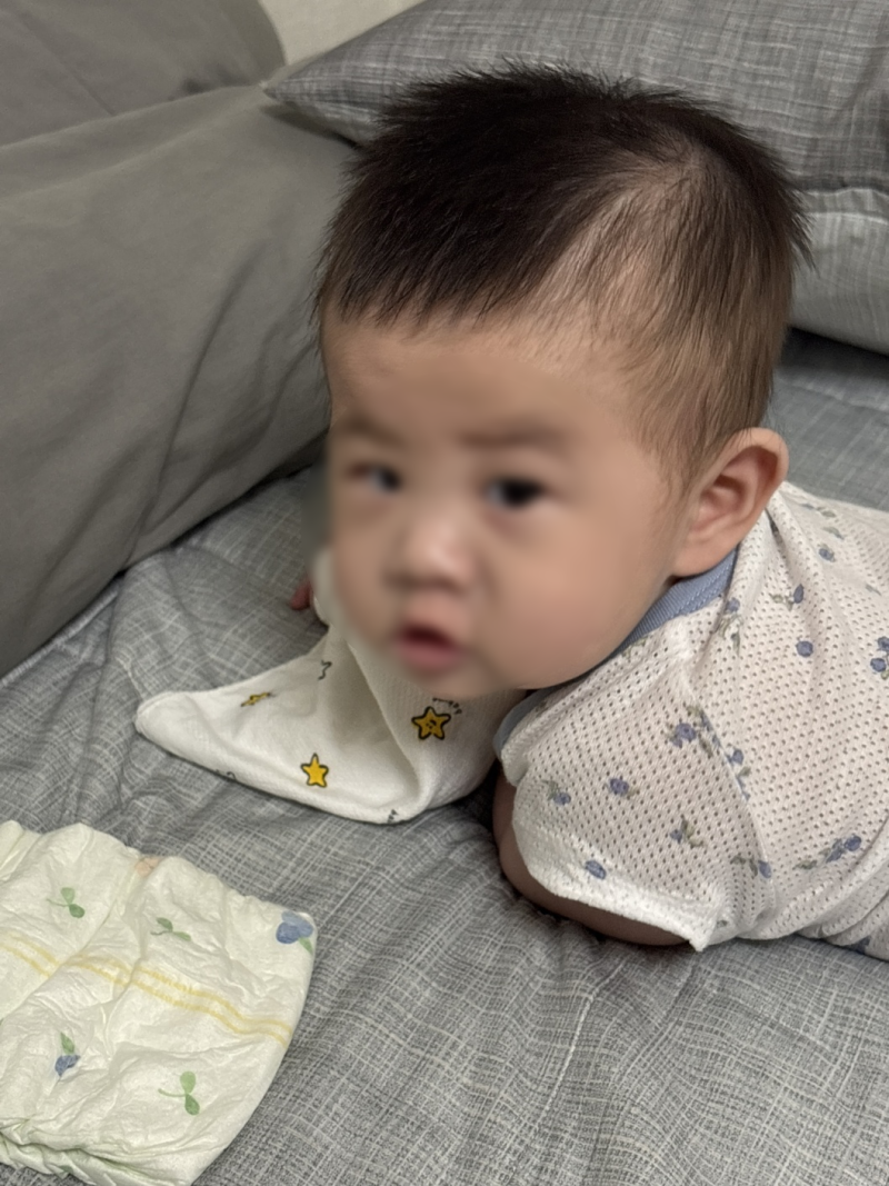 아기 턱 침독 비판텐 사용 될까