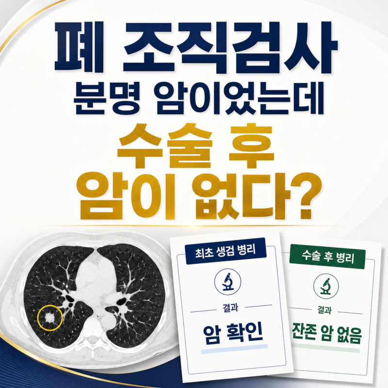 폐 조직검사에서는 암, 수술 후에는 암이 없다? 그래도 암진단비가 지급된 이유