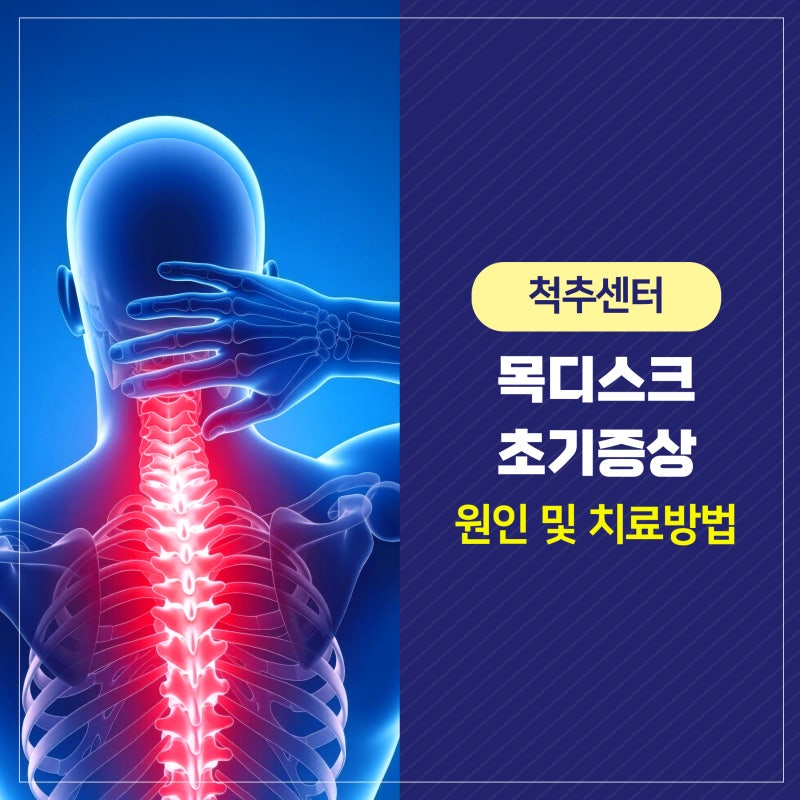 목디스크 초기증상, 원인 및 치료방법은?