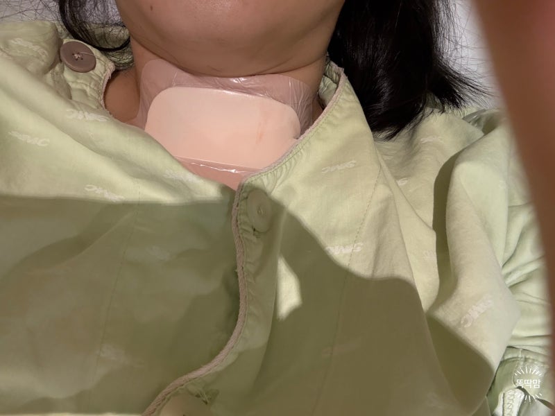 갑상선암 진단 기록 | 여섯번째 이야기 갑상선암 수술 후 목 흉터 7개월 변화, 메피폼·리메스....