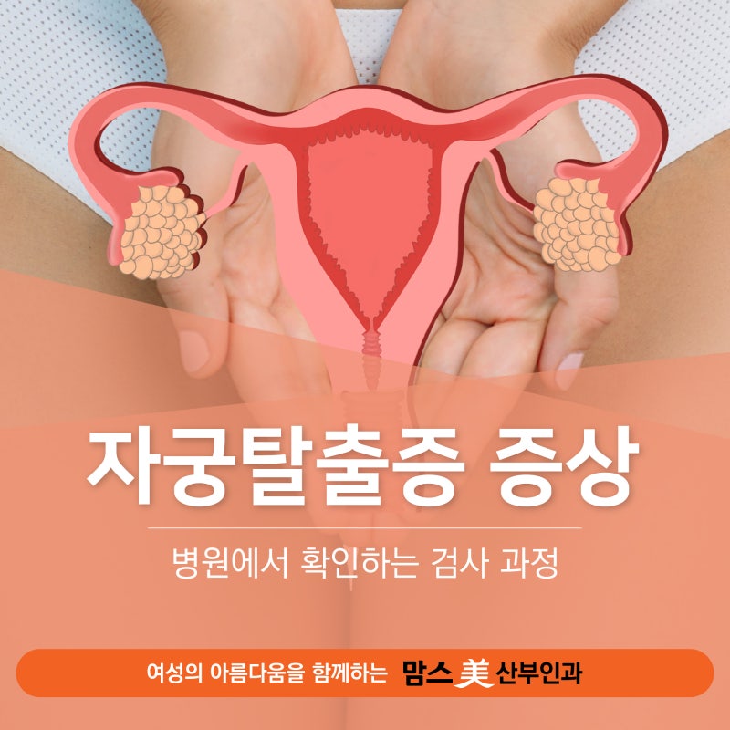 연신내역 산부인과 자궁탈출증 증상 및 병원에서 확인하는 검사 과정