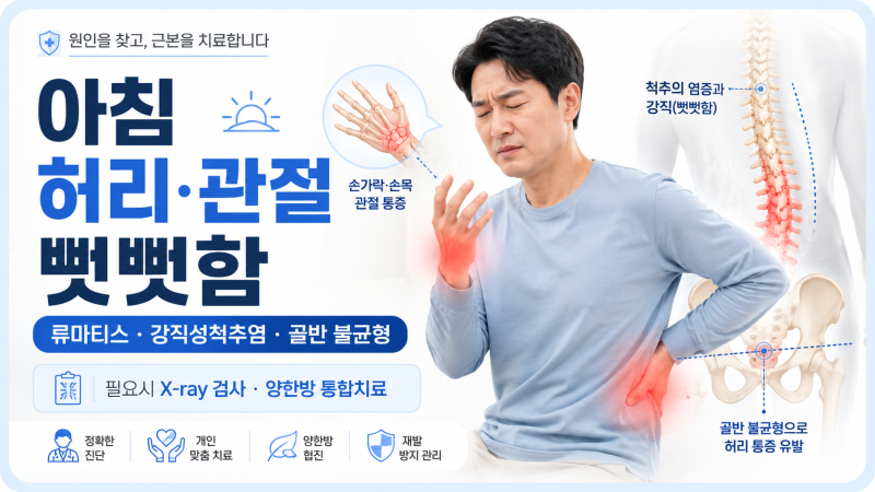 대전 양한방 “류마티스관절염 초기증상과 강직성척추염 증상, 아침 관절 뻣뻣함 그냥 넘기....