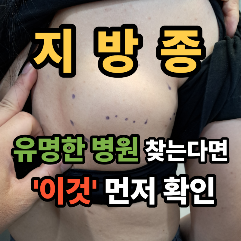 서울 지방종 유명한 병원? ‘이것’ 먼저 꼭 확인하세요