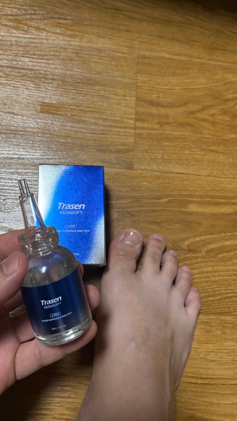 손발톱 갈라짐 고민이라면, 트라센 문제성발톱 케라소프트 앰플 추천