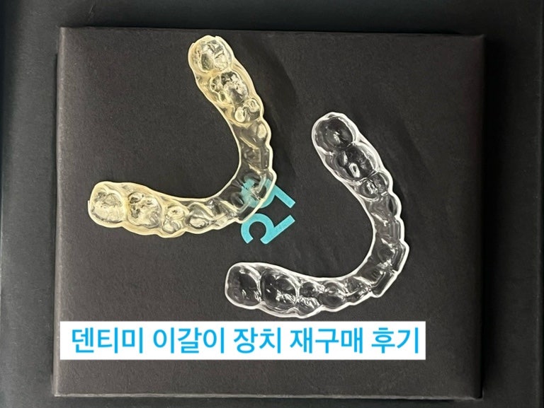 20대 여자 이갈이 교정장치, 치과 대신 덴티미 마우스피스 맞추기 (최소 30만원 아낌)