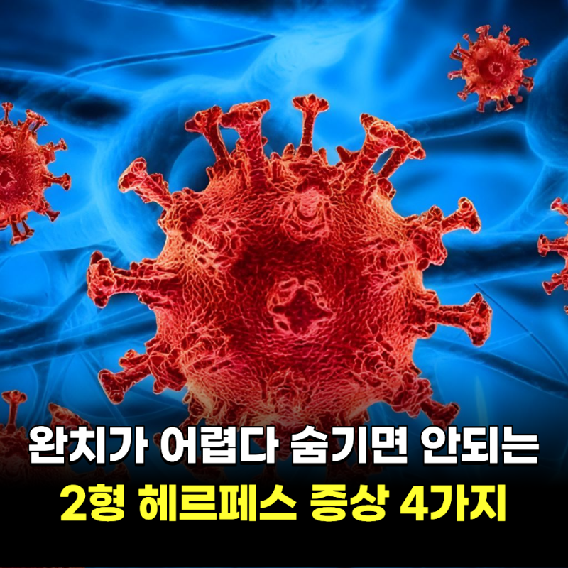 "완치가 어렵다.." 숨기면 안되는 2형 헤르페스 증상 4가지