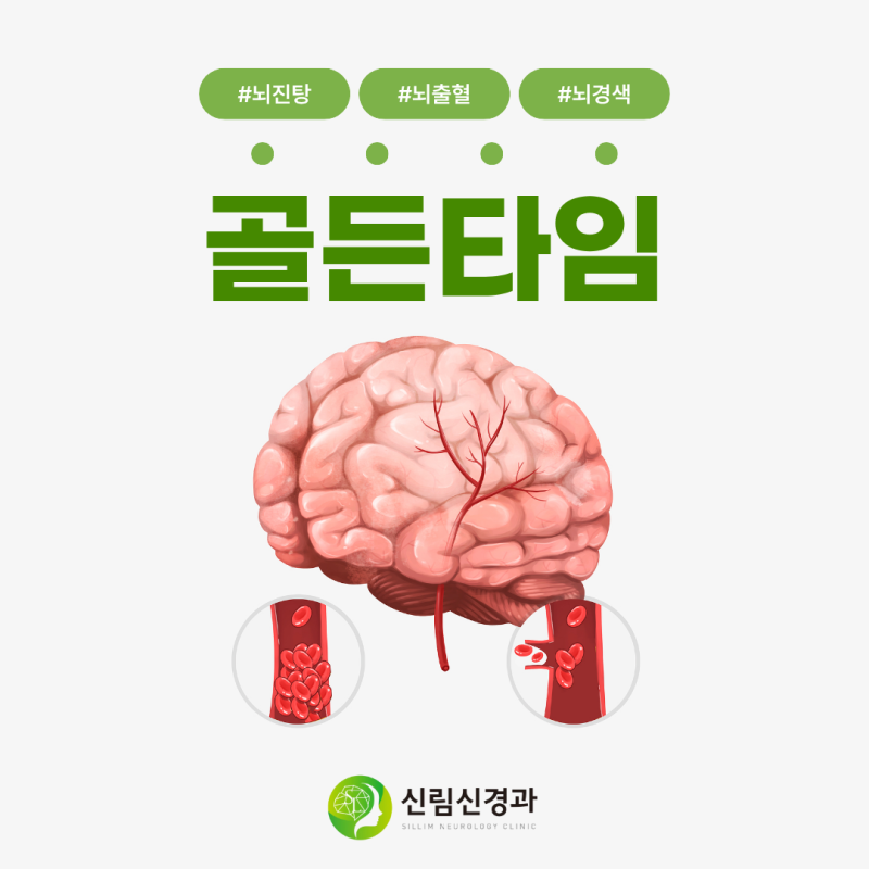 뇌진탕, 뇌출혈, 뇌경색, 골든타임은 몇 시간?