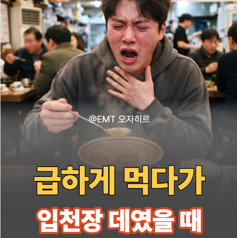 앗 뜨거워! 뜨거운 국물에 입천장·식도 데었을 때 응급처치와 꿀팁 총정리