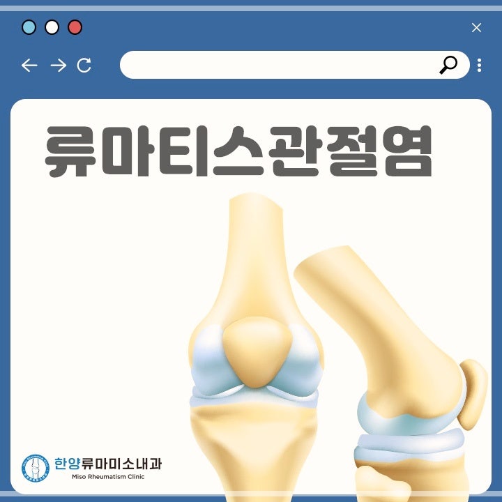 신정동내과 류마티스 관절염에 도움이 되는 음식, 식습관