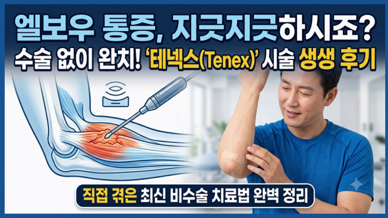 테넥스 시술 후기: 양팔 테니스·골프 엘보 치료기