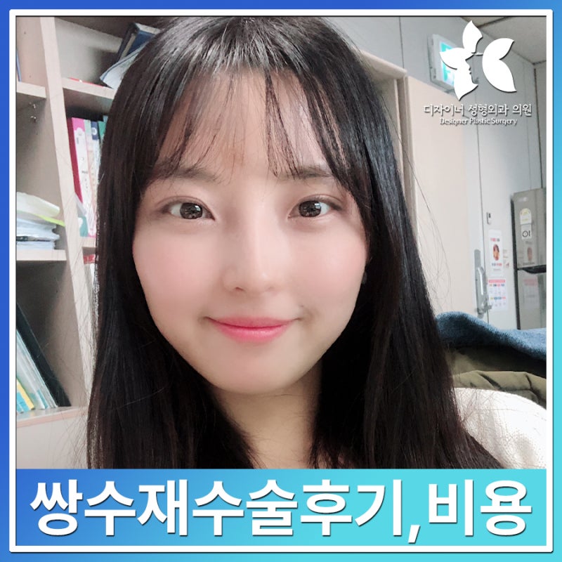쌍수 재수술 후기, 쌍꺼풀재수술은 어떻게 할까? 쌍수재수술비용까지