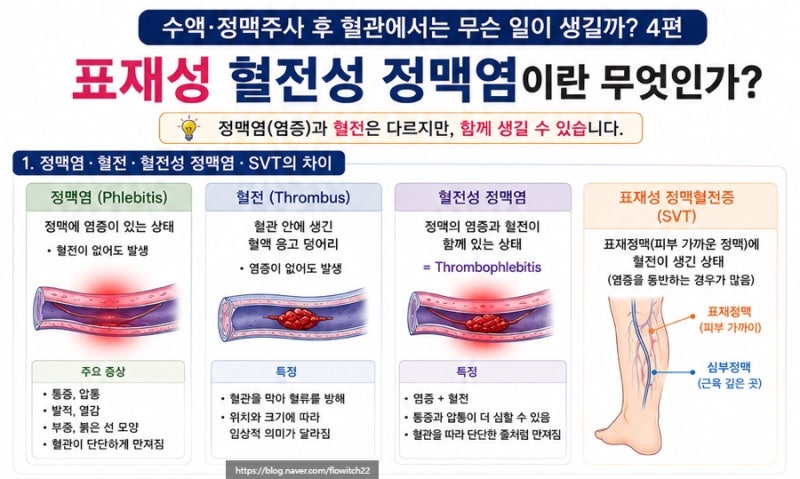 수액·정맥주사 후 혈관 부작용ㅣ표재성 혈전성 정맥염이란 무엇인가④