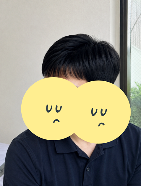 30대 남자 미녹신카 엠자탈모 내돈내산 후기