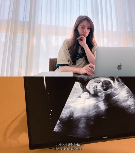 안나 넷째 임신 걱정 쏟아지자 직접 입 열었다…“의사가 괜찮다고 했다”