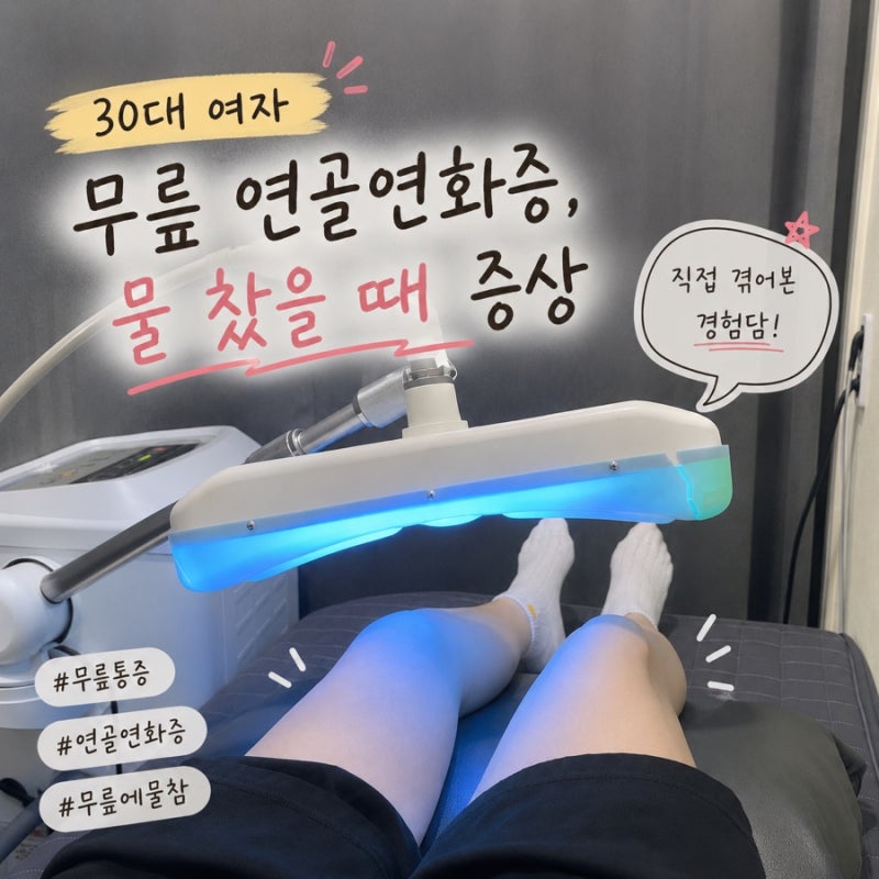 30대 무릎 연골연화증 치료 & 물 찼을 때 증상 후기 | 잠스트 무릎보호대 추천 내돈내산