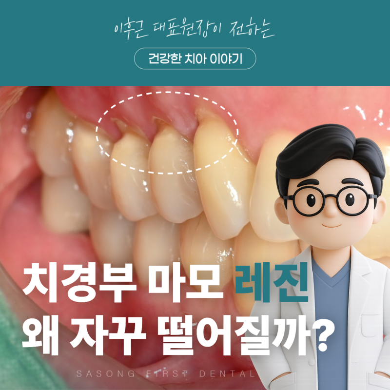 치경부 마모증 레진 격리와 방습 중요한 이유