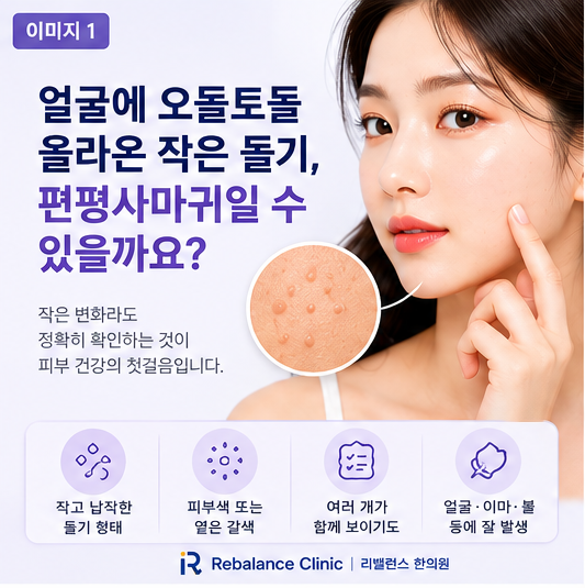편평사마귀가 갑자기 많아진 이유? 얼굴에 번지는 원인과 주의할 행동