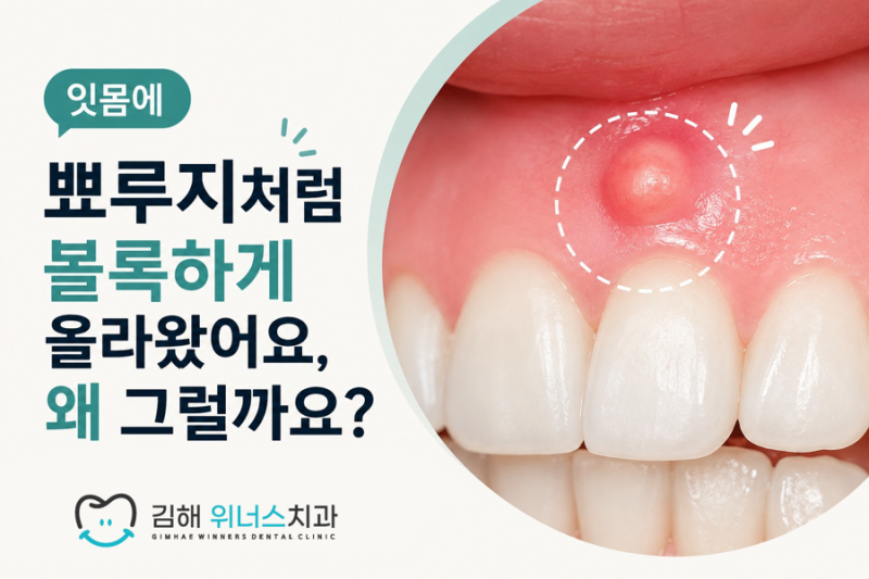 잇몸에 뾰루지처럼 볼록하게 올라왔어요, 왜 그럴까요?