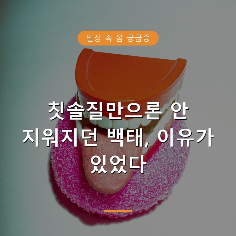 혀 백태 없애는 방법과 혀클리너 올바른 사용법