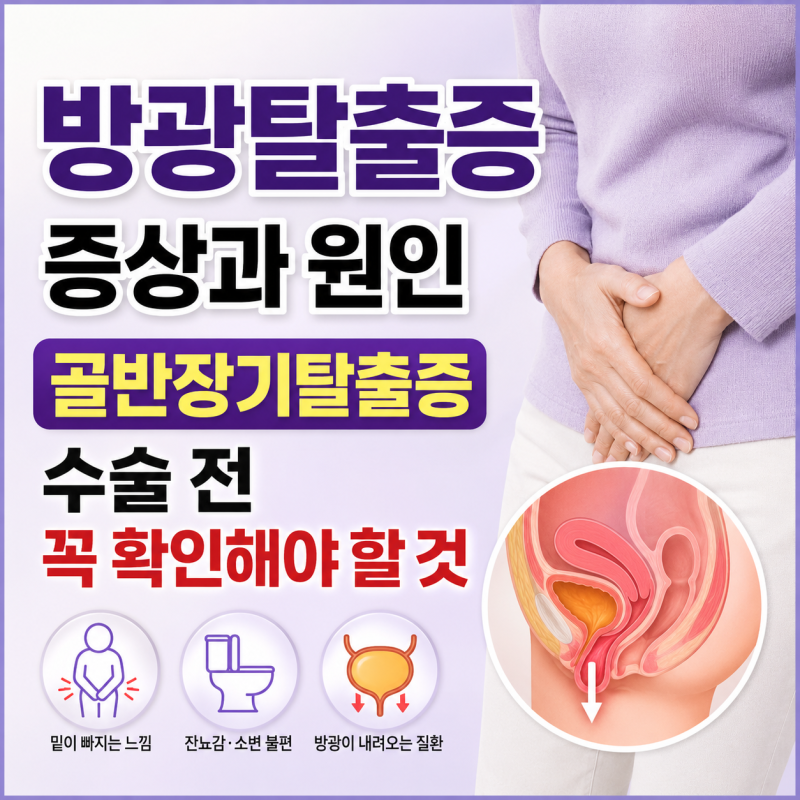 방광탈출증 증상과 원인, 골반장기탈출증 수술 전 꼭 확인해야 할 것
