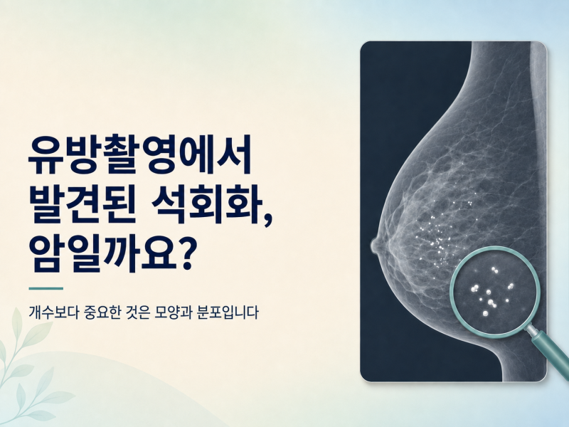 유방촬영에서 발견된 석회화, 암일까요?