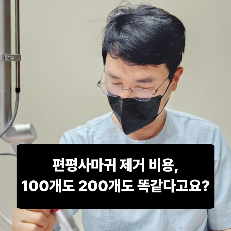 편평사마귀 제거 비용, 100개도 200개도 똑같다고요?