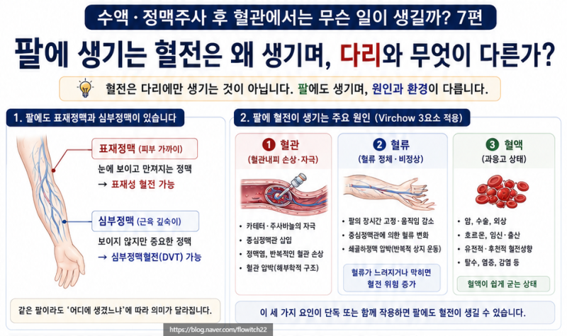 팔에 생기는 혈전은 왜 생기며, 다리와 무엇이 다른가⑦