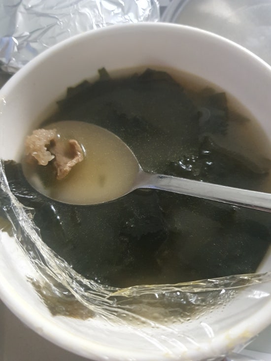 이식 입원