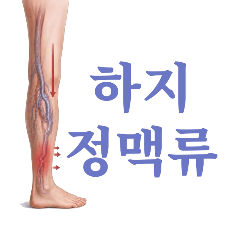 수원 하지정맥류 다양한 치료법: 나에게 맞는 치료는?