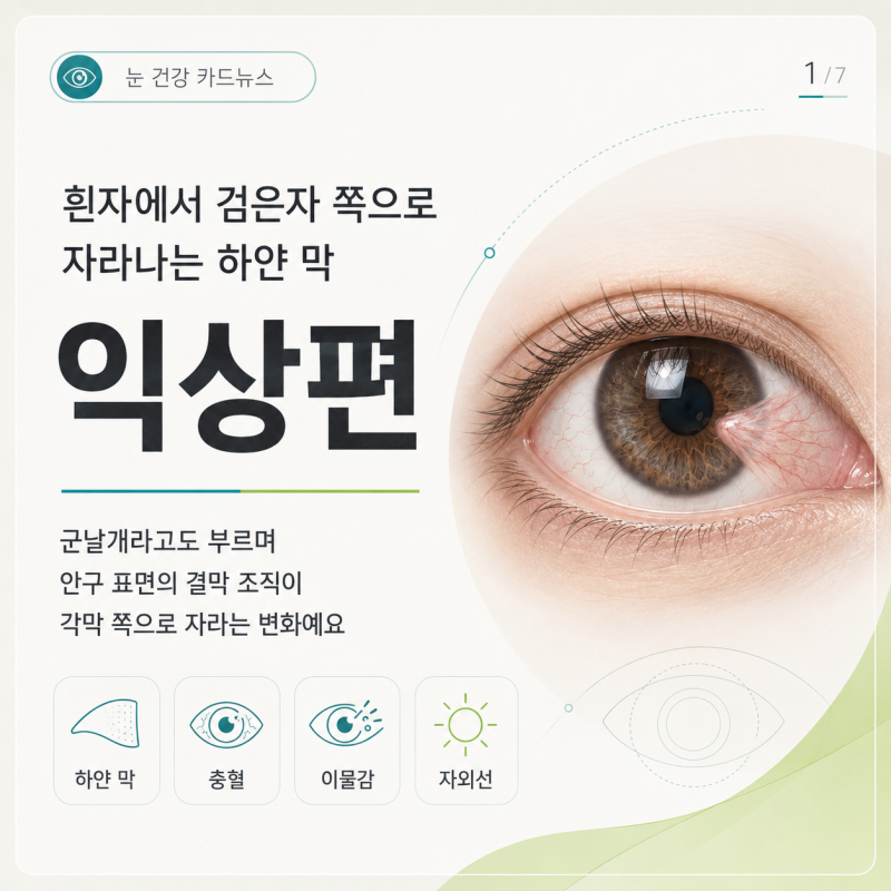 눈 익상편 증상, 각막 쪽으로 자라는 이유와 시야를 지키는 방법
