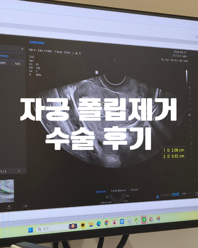 자궁 폴립 제거 수술 후기 | 수면마취 중 통증에 깬 지옥체험, 비용·보험처리까지