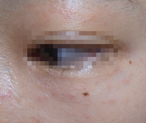 [PX 스킨케어 사용 후기] 아누아 80+ 앰플, 닥터지 레드블레미쉬 에센스, 파넬 시카마누 92 세럼....