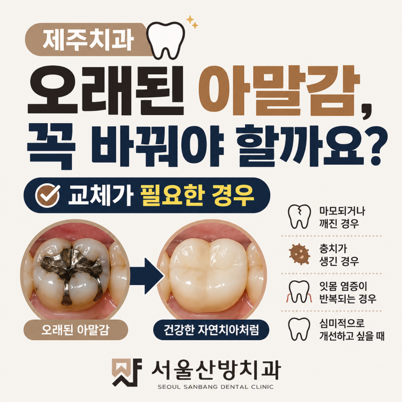 제주치과 오래된 아말감, 꼭 바꿔야 할까요? 교체가 필요한 경우