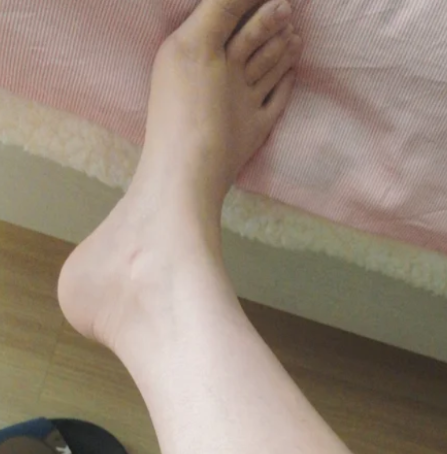 발목 건초염 발목 안쪽이나 바깥쪽이 시큰거릴 때 관리법