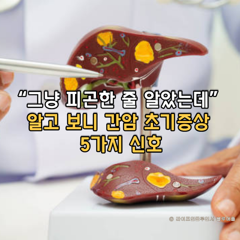 "그냥 피곤한 줄 알았는데" 알고 보니 간암 초기증상 5가지 신호