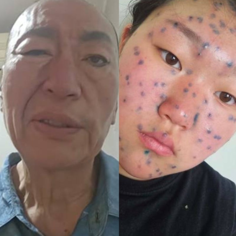 3번째 구안와사에 뇌병변 위험 진단 받았는데...딸 살리려 떠난 유퉁의 감동 부성애