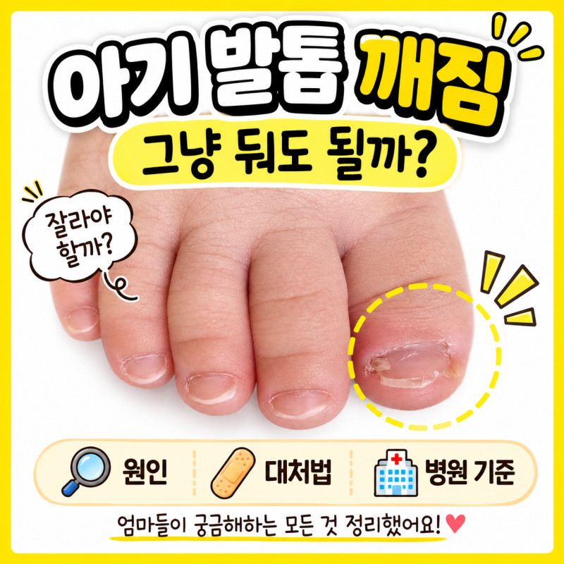아기 발톱 깨짐 그냥 둬도 될까? 원인부터 대처법·병원 기준까지
