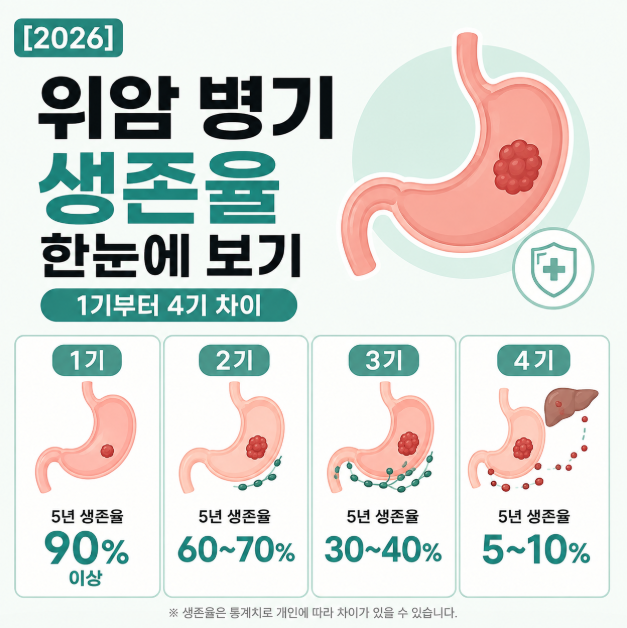 위암 병기 생존율 한눈에 보기: 1기부터 4기 차이는 무엇인가요
